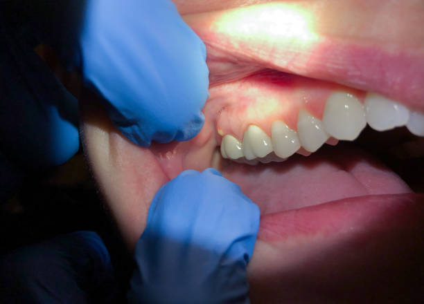 Best After-Hours Emergency Dentist in Purdy, WA