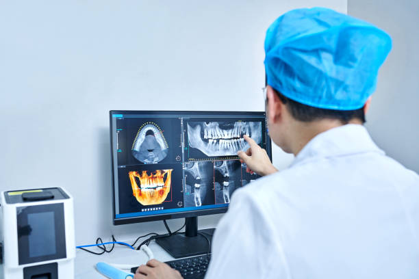 Best Emergency Tooth Extraction in Purdy, WA